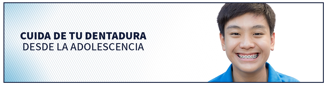 La ortodoncia rápida es ideal para adolescentes y adultos Adolescente mostrando ortodoncia rápida en Bogotá
