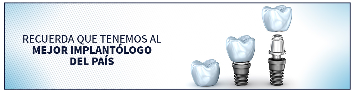 Somos los únicos especializados en implantología en Bogotá Muestra de implantología en Bogotá